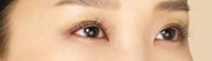Latisse Longer, Thicker Eyelashes Beverly Hills | Los Angeles CA Med Spa