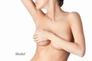 Factors to Consider before Breast Augmentation