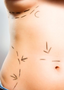 How long is recovery after body lift plastic surgery?